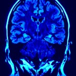 I Think I Have a Hermaphrodite Brain