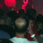 thebackofthirstydaveshead